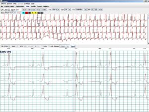 Holter LX Analysis Sentinel Dongle Emulator