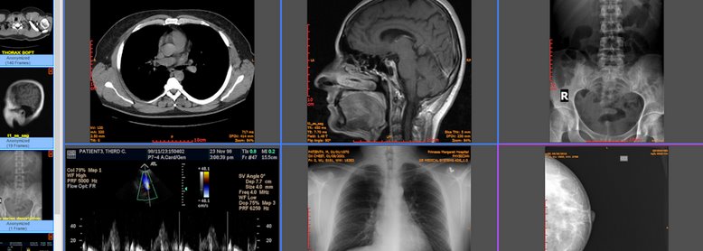 Visual MED Dicom