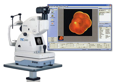 IMAGEnet TOPCON Digital Imaging System