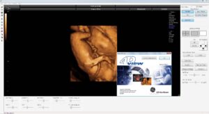 4D View GE Healthcare Version 14 HASP Dongle