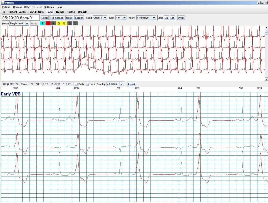 Holter LX Analysis Sentinel Dongle Emulator