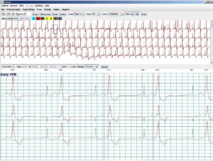 Holter LX Analysis Sentinel Dongle Emulator