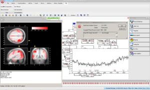 Brain Products Analyzer 2 Hasp HL Dongle